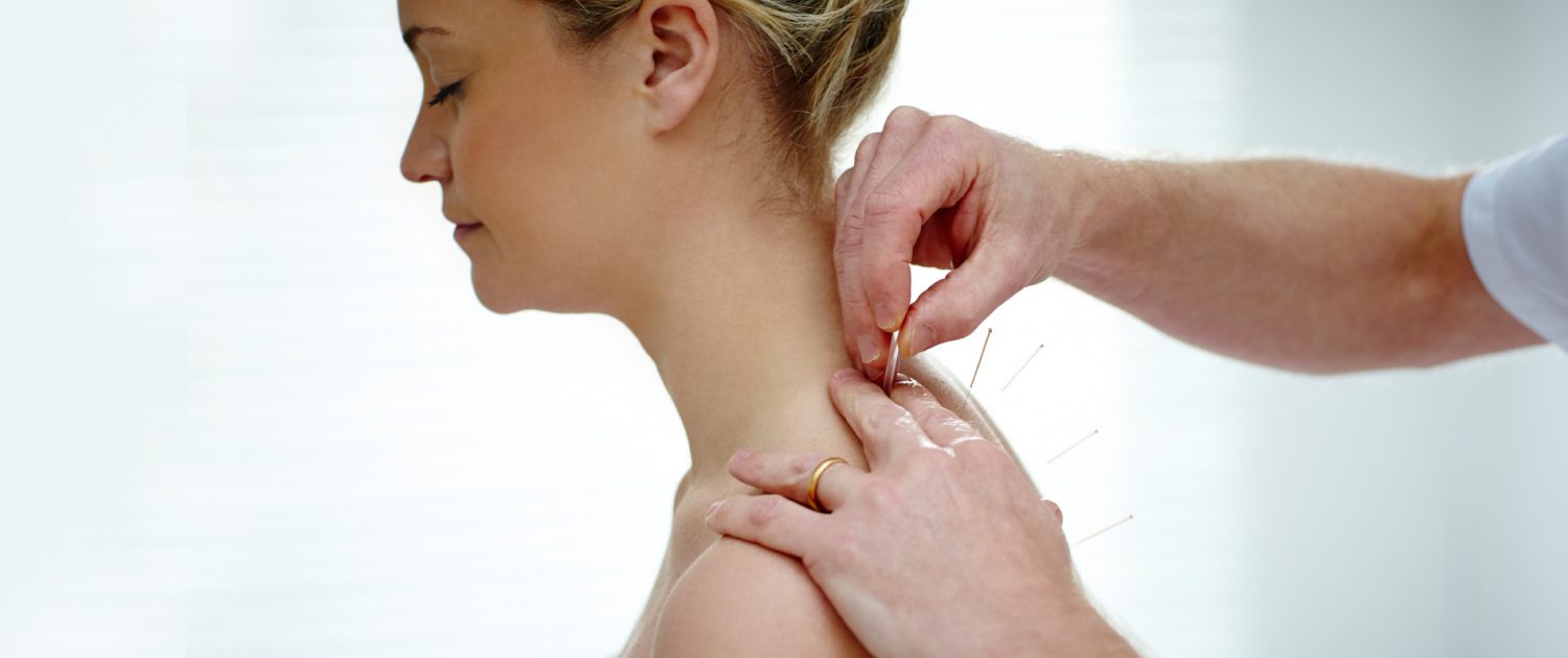 Acupuncture Treatment